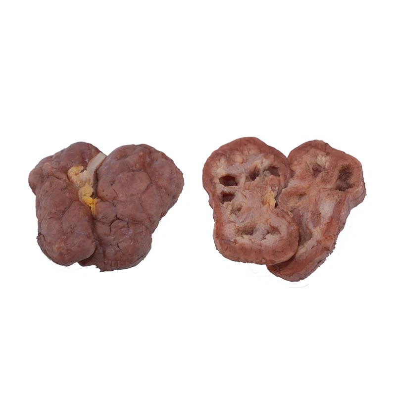 Renal Tuberculosis Model Renal Tuberculosis Model